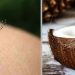 Bon à savoir: Découvrez cette nouvelle astuce de noix de coco pour se débarrasser des moustiques