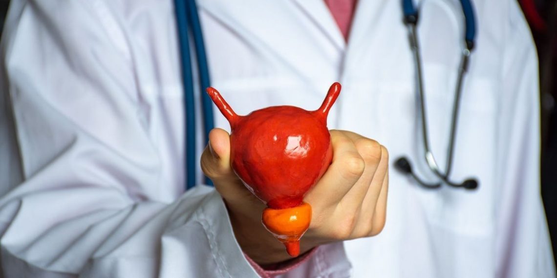 Cancer de la vessie : Ces signes qui doivent vous alerter